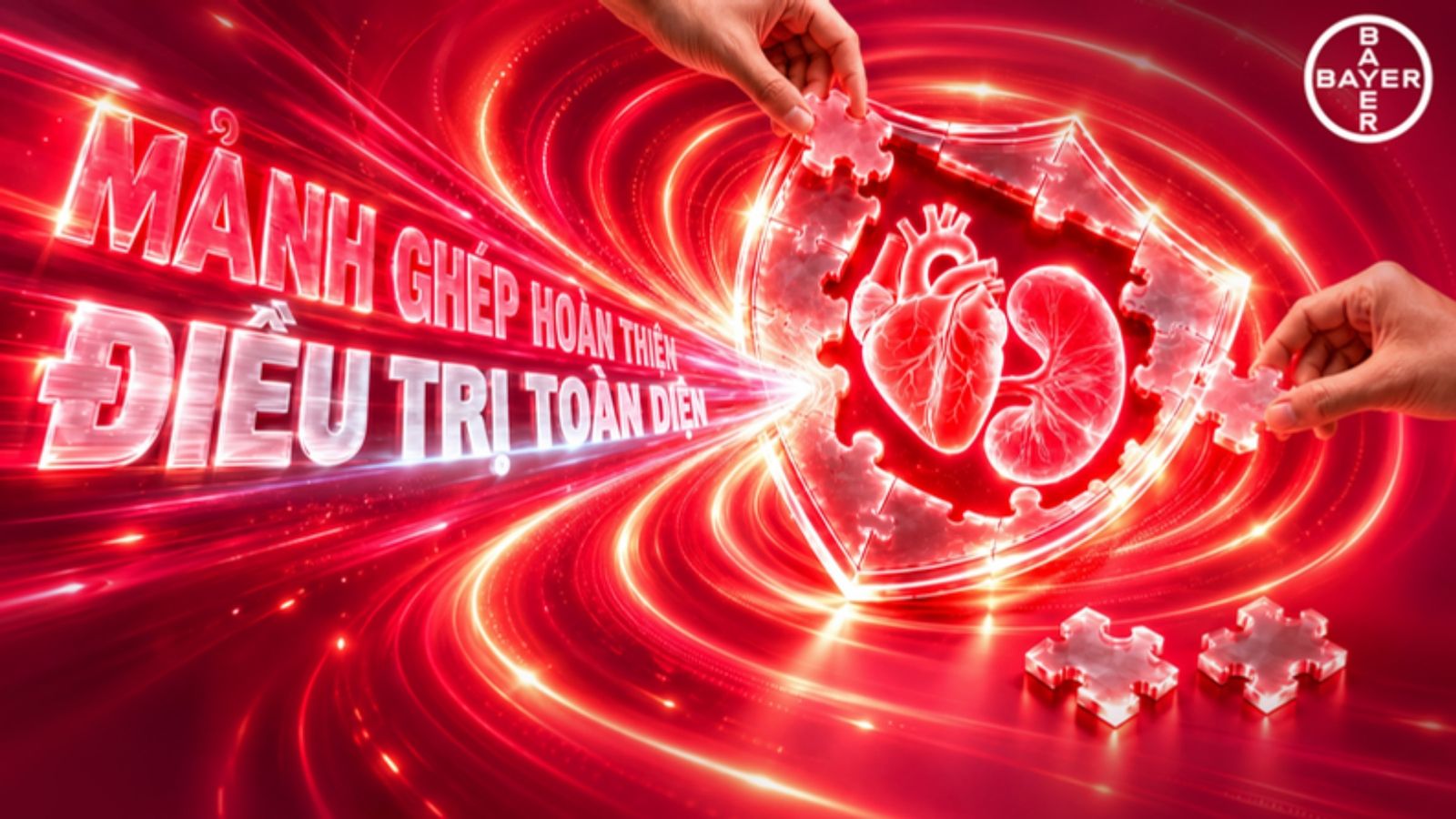 Option 2 · Mảnh ghép hoàn thiện